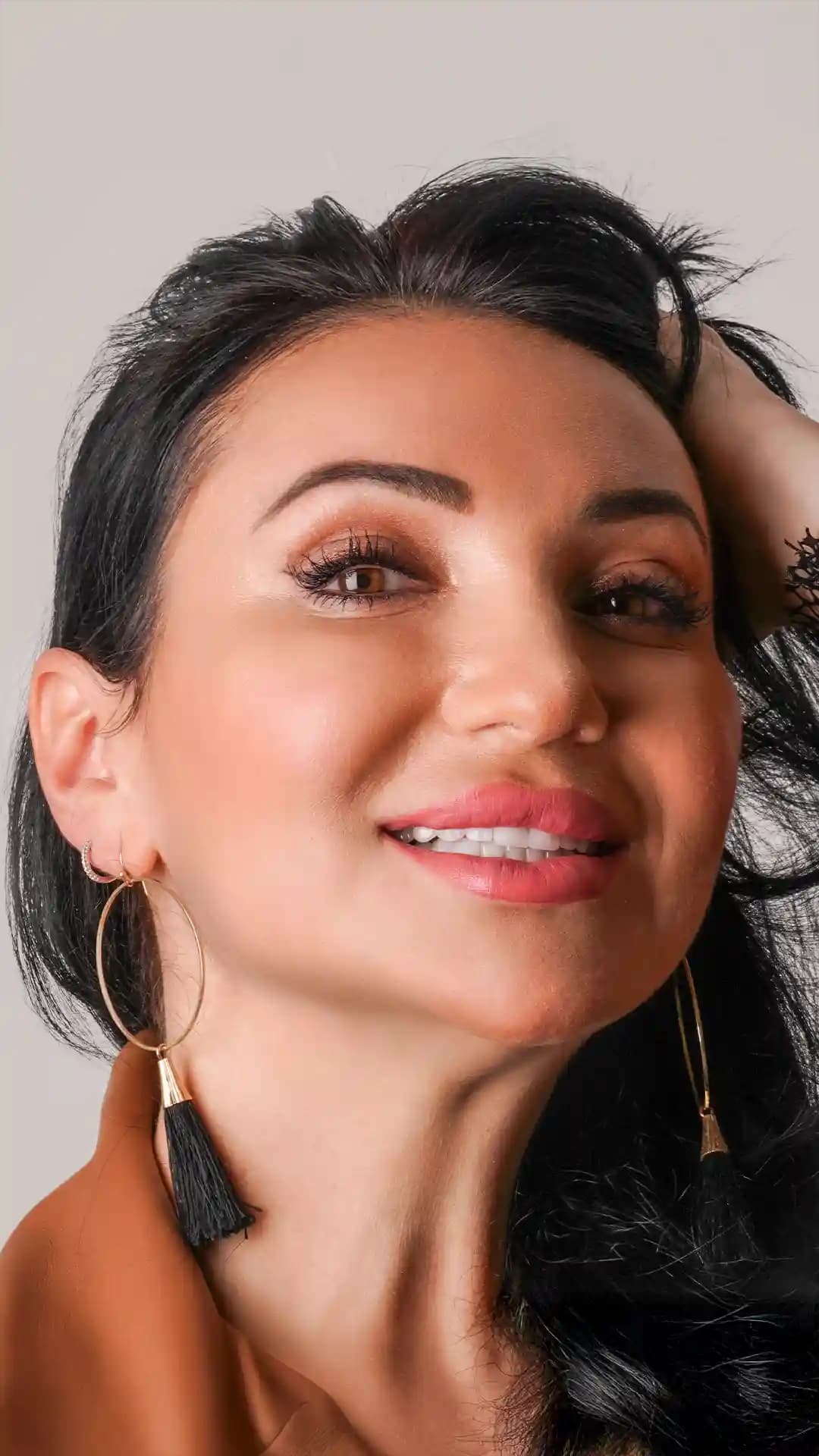 Liza N. Dental Veneers
