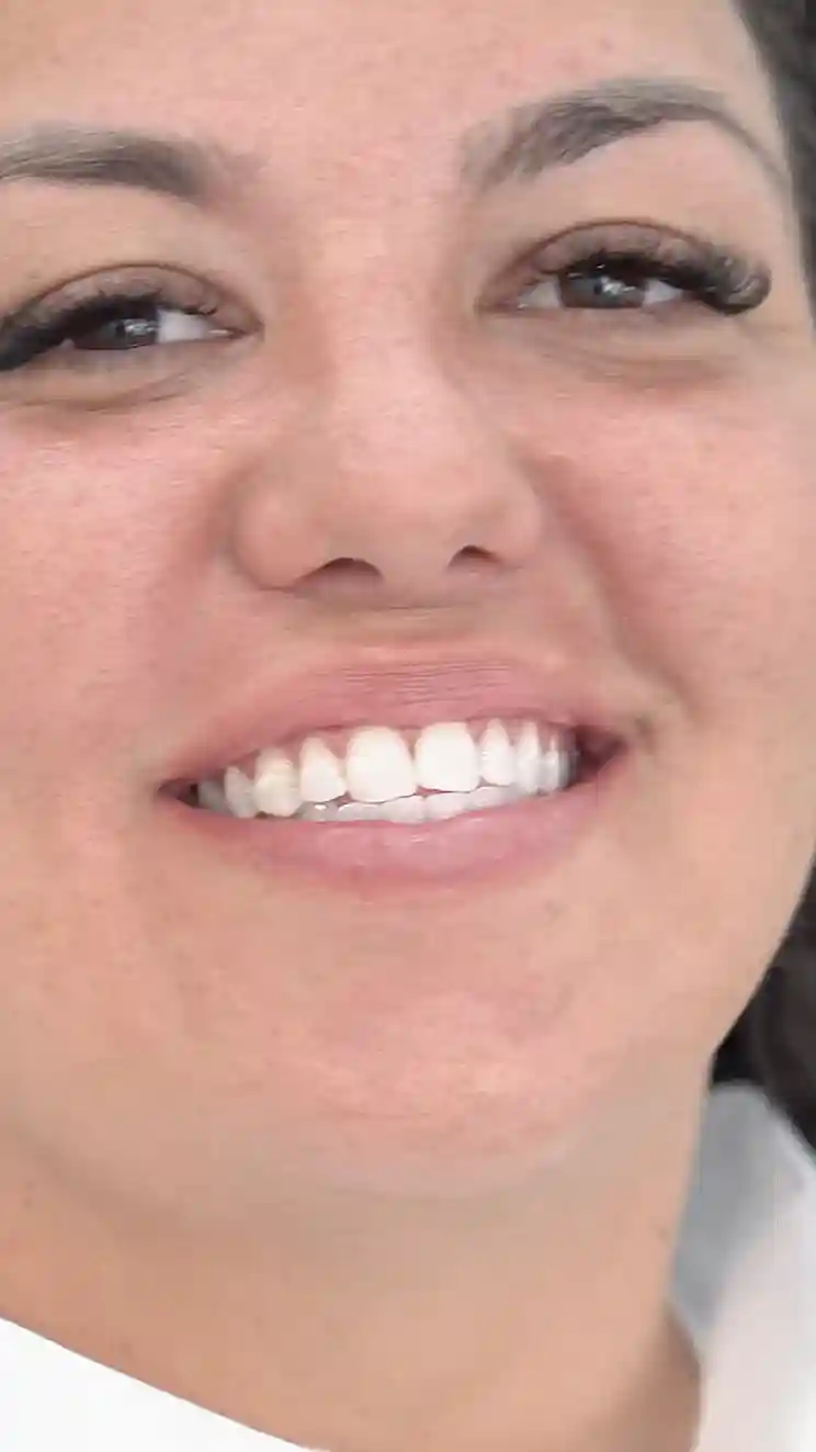 Whitening